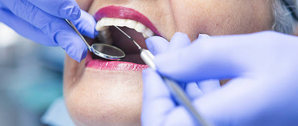 Best Emergency Dental Extractions in Malvern, PA